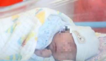 罹患复杂危重先心病的“袖珍宝宝”上海康复出院 心脏比鸽蛋还小