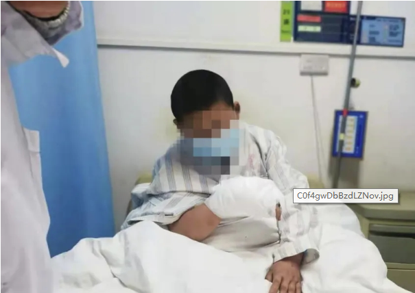 商洛11岁男孩放炮不慎被炸成重伤 手指成“骨架”险截肢