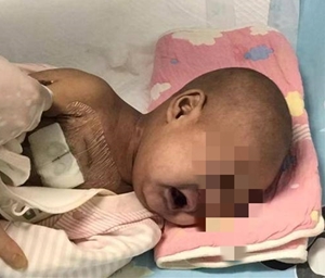 陕西6个月大男婴患罕见病 辗转多家医院每天被病痛折磨