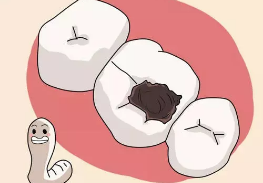 为什么孩子容易长蛀牙？医生分析了这5个原因