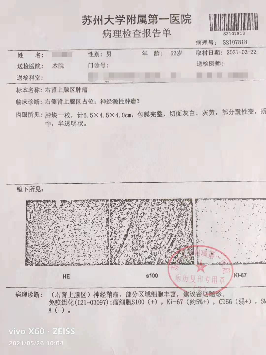 康涛的病例报告  本文图片均由受访者提供