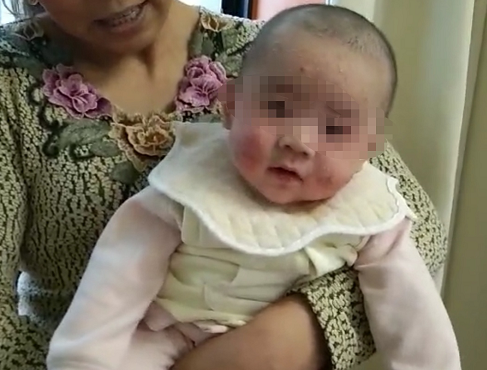 紧急求助！商洛山阳县9个月大婴儿身患多种病症 家人快愁死了