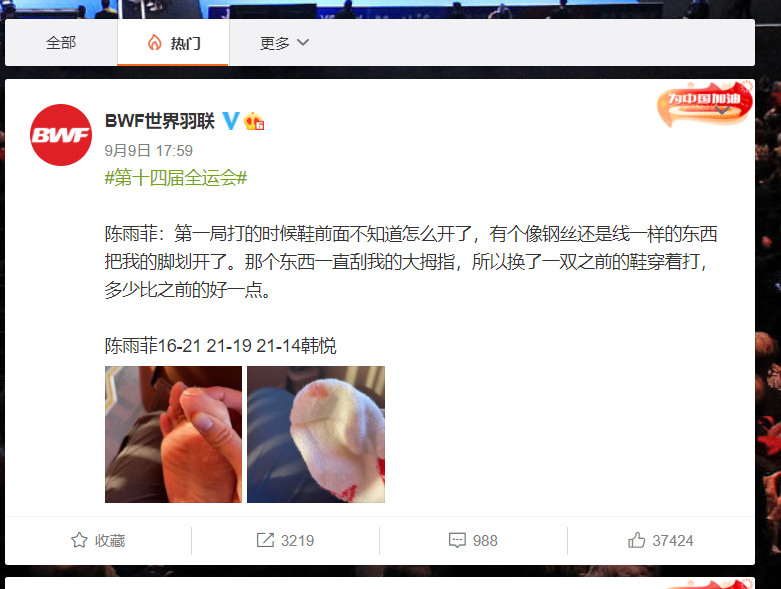 陈雨菲受伤的脚。 微博@BWF世界羽联