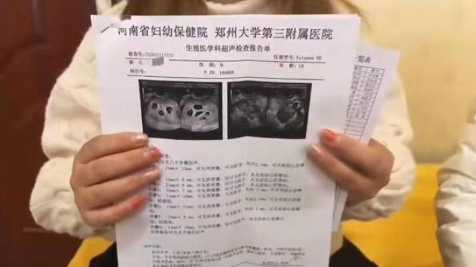 郑州怀八胞胎女子年仅18岁 其家属确认曾打过促排卵针