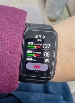 华为Watch D血压检测手表曝光：可测高压、低压、脉搏