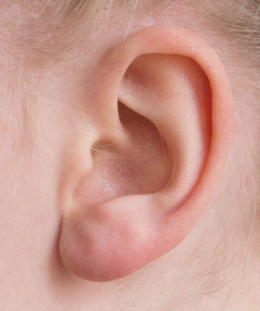 男子足療后采耳致腳氣進耳 為什么不建議掏耳朵