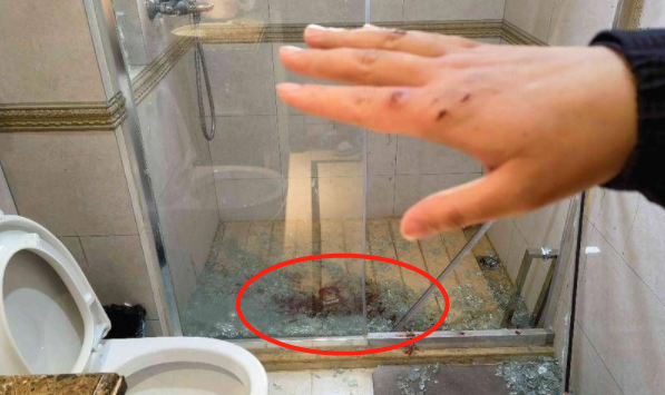 西安业主夫妻二人正在卫生间 浴室玻璃门突然炸裂致两人多处划伤