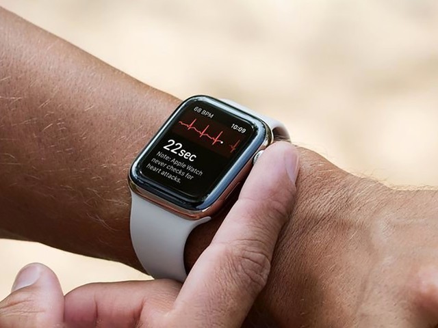AI和Apple Watch結合將啟動前瞻性研究，新算法可檢測出弱心肌?!