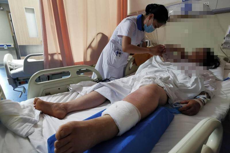 盛夏当心蛇出没！陕西省人民医院急诊外科每天都有三五例蛇咬伤患者
