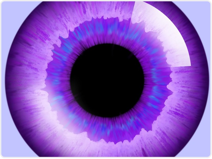 哪些情况下不能佩戴隐形眼镜?教你如何挑选合适的隐形眼镜!