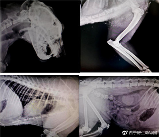 凌夏X光照片
