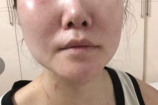 女子遭丈夫家暴后被判不予离婚 当事人：和孩子每天都活在恐惧中