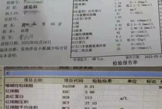 河南3名老人因蜱虫病病逝 曾一同为去世感染者净身