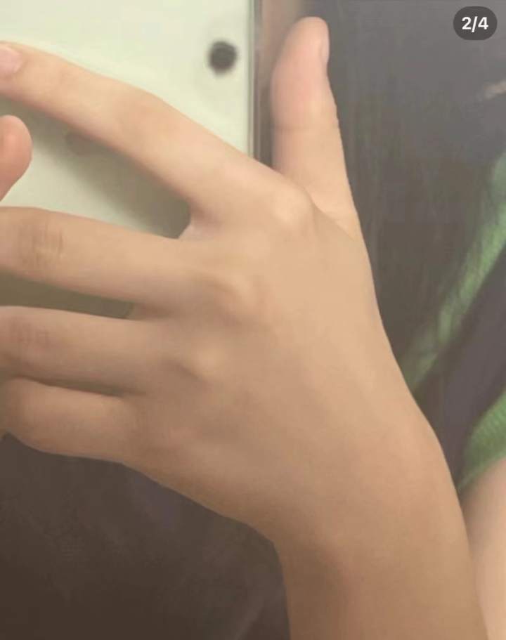 \