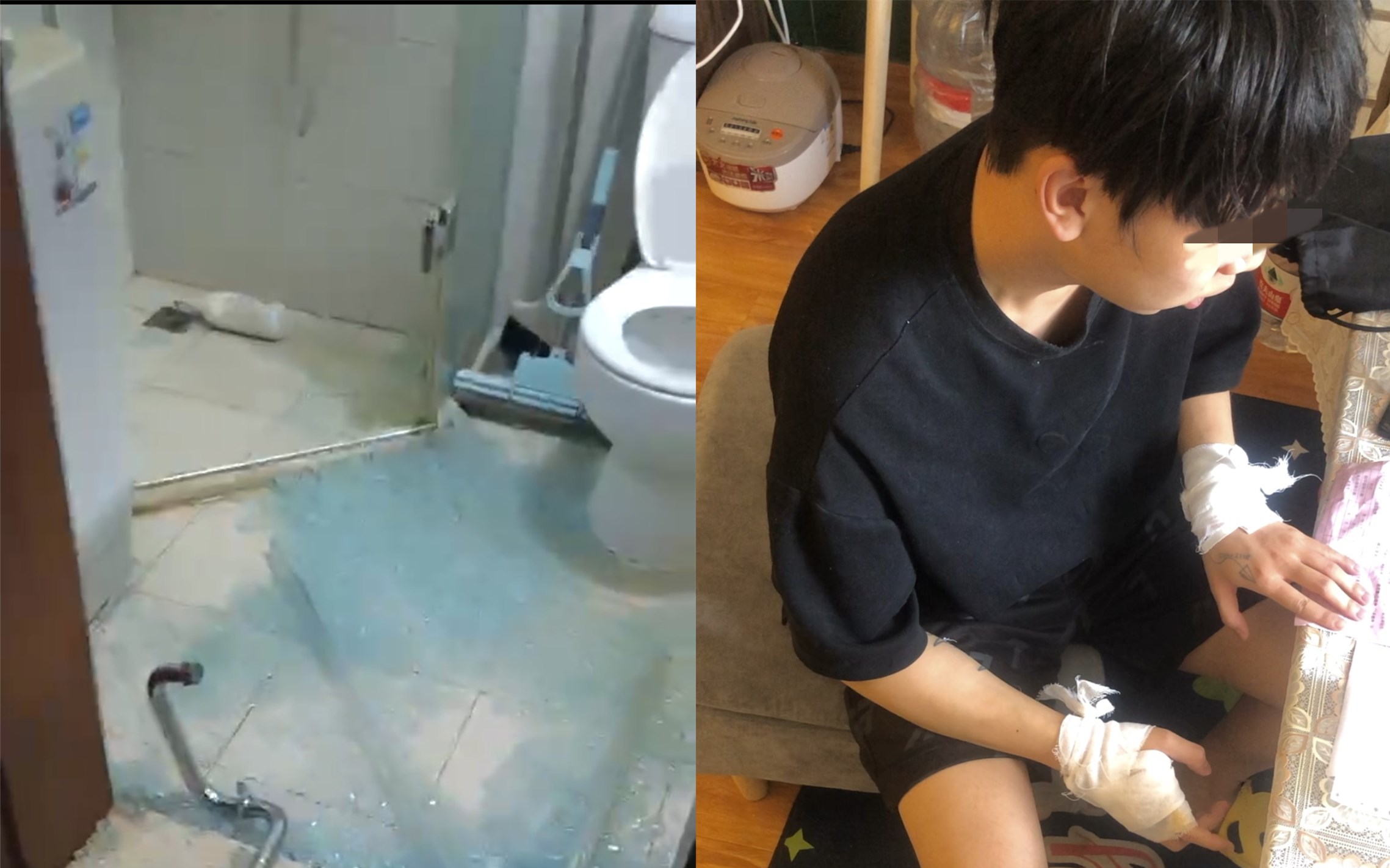 凌晨洗完澡酒店浴室玻璃门突然炸裂 小伙多处划伤