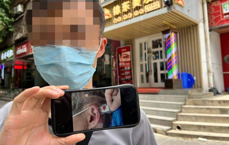 在徐东美发西安一连锁店理发剪到耳朵 男子左耳被缝三针