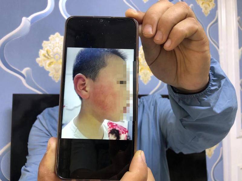 疑被小男孩骑平衡车挤碰 西安男子扇两巴掌致7岁孩子鼓膜穿孔