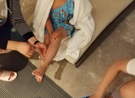 6岁女孩西安经开洲际酒店游泳 出水发现膝盖被划开一道口子