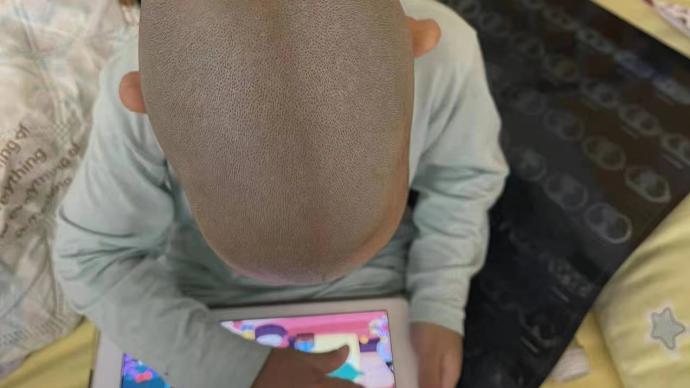 私立诊所儿保三年未发现孩子颅缝早闭？卓正医疗：正和家长协商