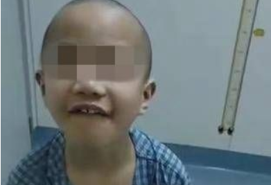 8岁孩子患上极重型再生障碍贫血 还反过来鼓励安慰妈妈
