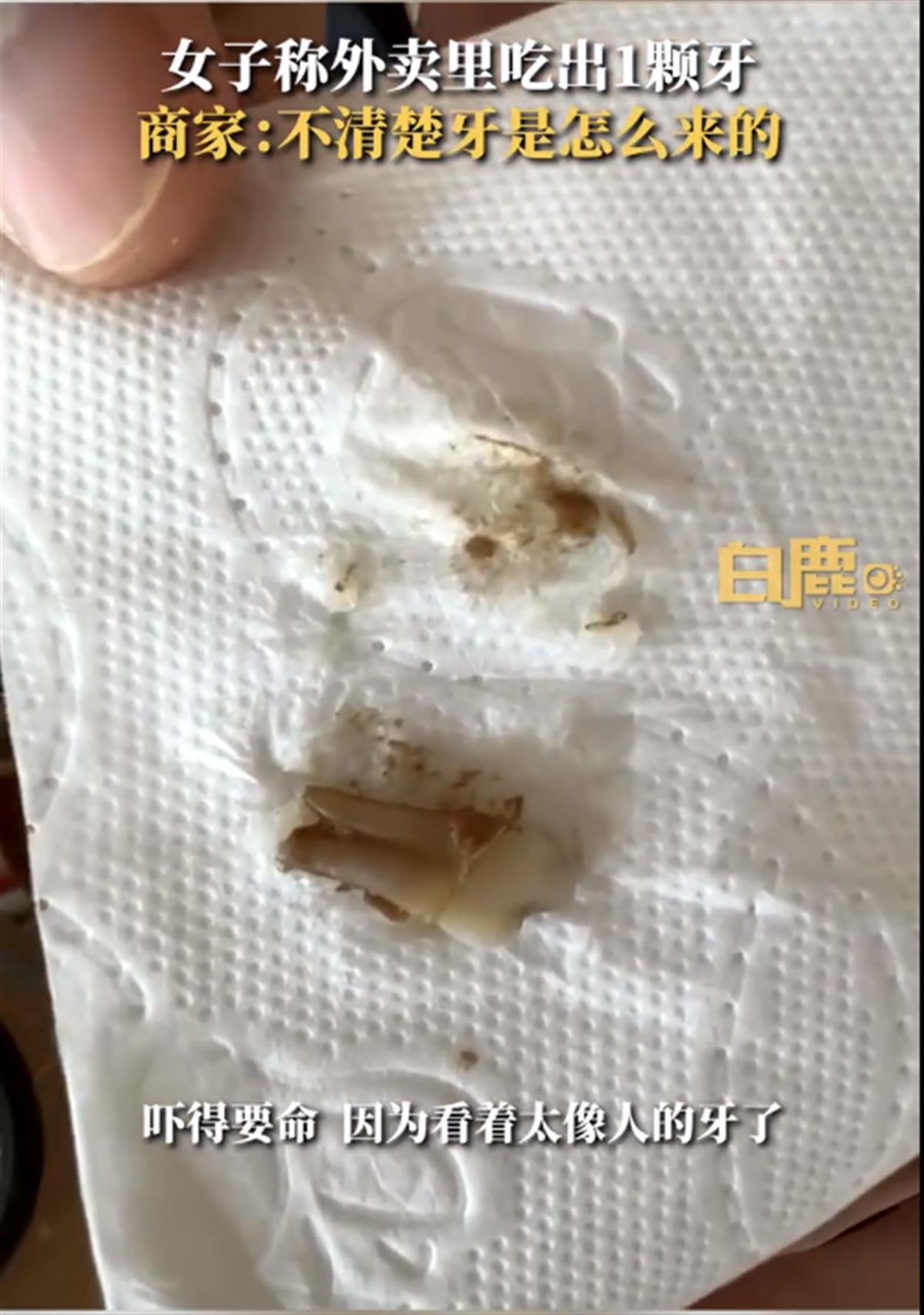 女子称外卖里吃出一颗牙吓得已报警 商家：不清楚是怎么来的
