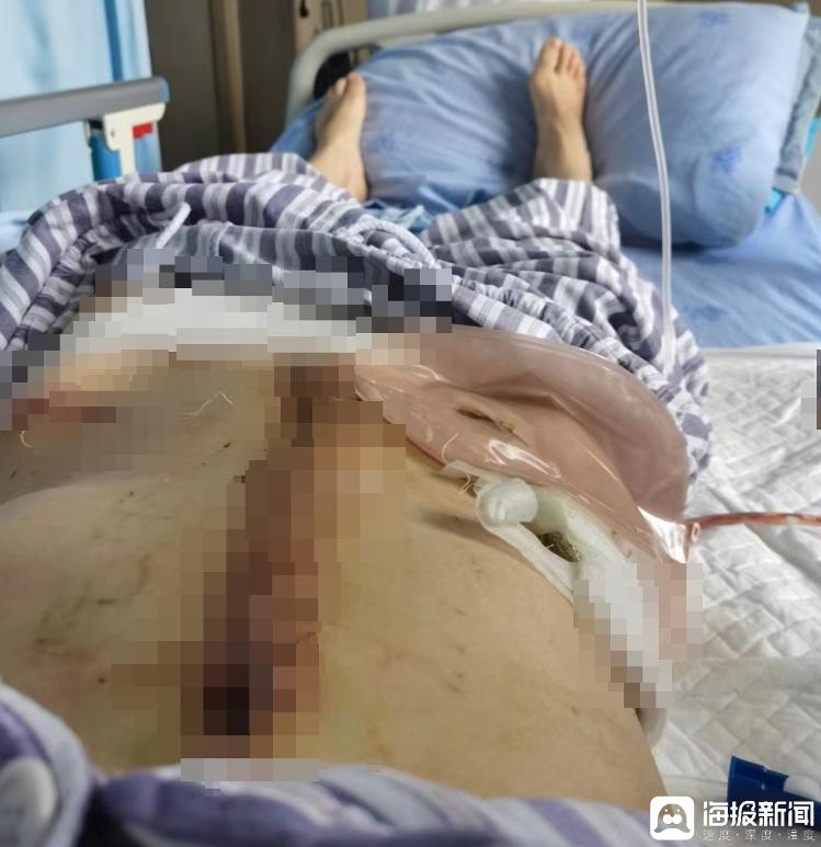 对话“两年被家暴16次”女子：为什么我逃也逃不了 离也离不掉